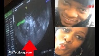 Remy Ma is Almost Pregnant & Papoose is So Happy ❤️ #BlackLove