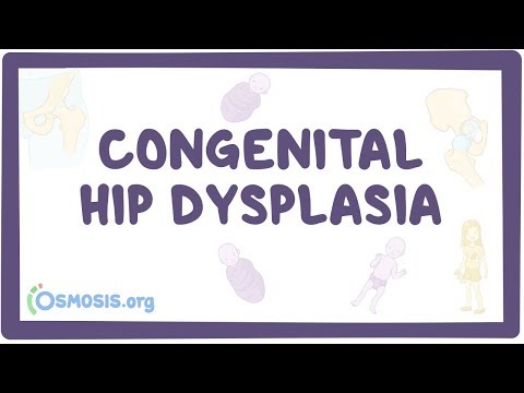 hip dysplasia kenőcs