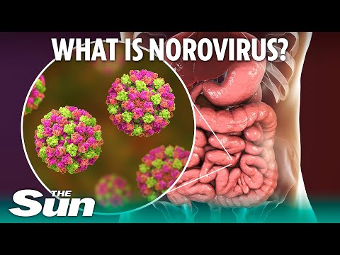 What is norovirus and how long does sickness bug last?