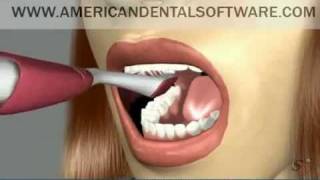 American Dental Software - Brushing in 3D video
