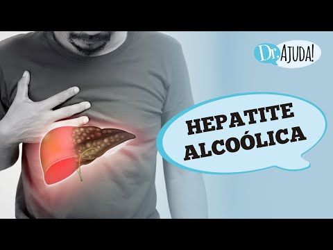 HEPATITE ALCOÓLICA E CIRROSE: SINTOMAS, DIAGNÓSTICO E TRATAMENTO