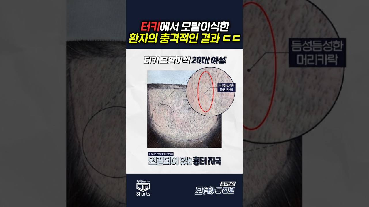 더원츠의원 숏폼