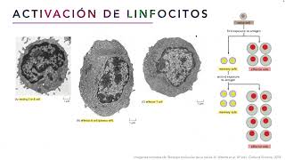 UC8-M2 T15: Tejido Linfoide