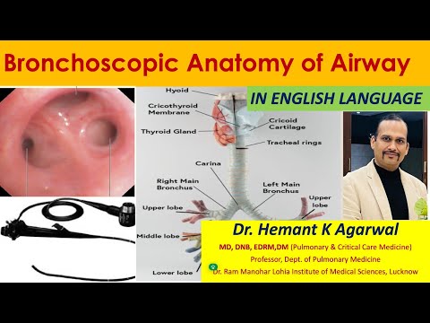 (ENGLISH) Bronchoscopic Anatomy of Airway/ Basics of Bronchoscopy/ Segments Identifications @Hemant