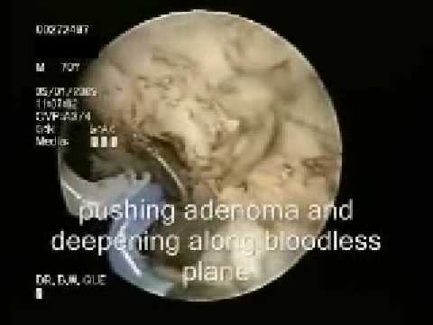 Die Einheit der magnetischen Therapie für Prostatitis Entzündung der Prostata und Kopfschmerzen