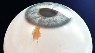Kelly Vision