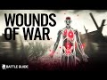 Wounded on The Western Front - A Death Sentence? (WW1 Documentary)