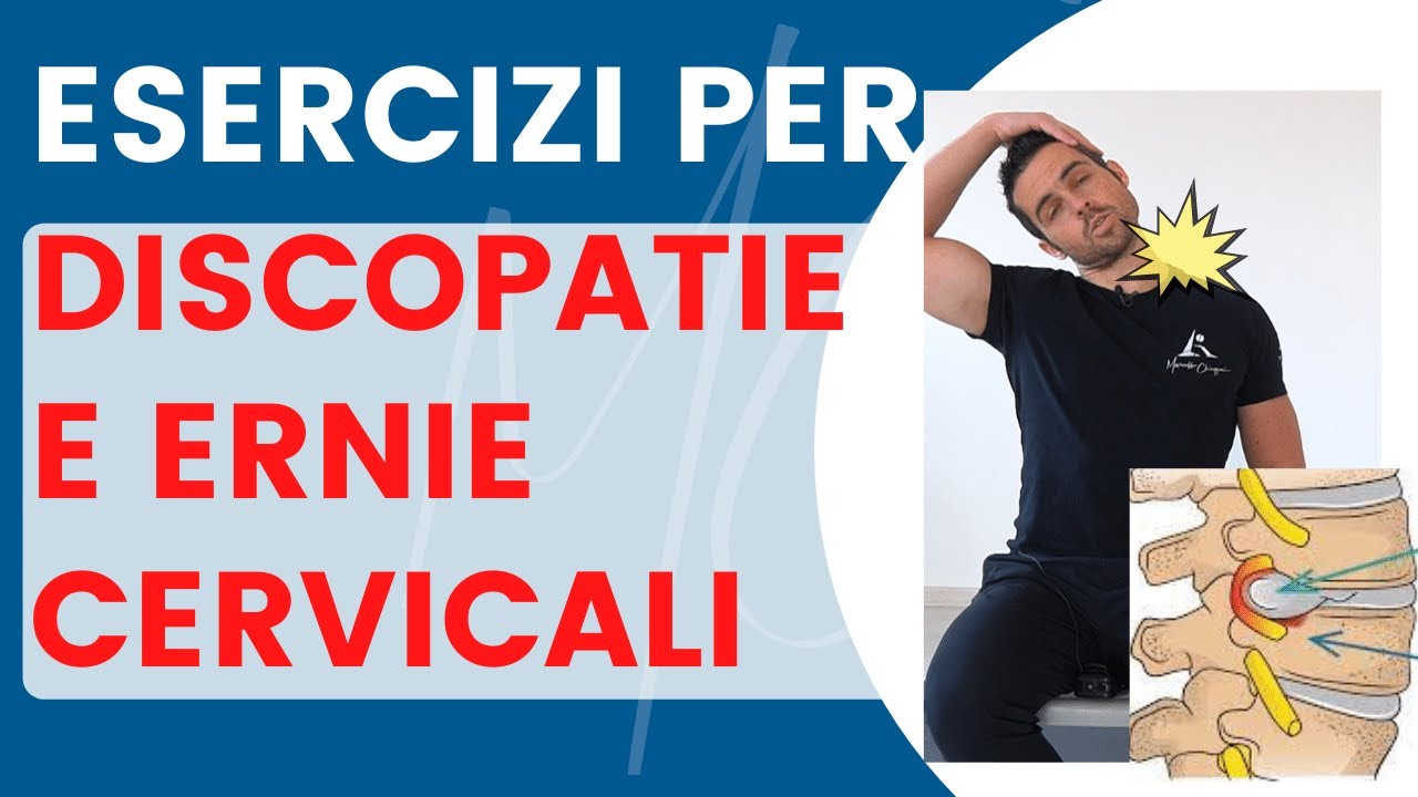Discopatia o ernia CERVICALE: i migliori esercizi