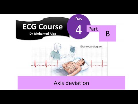 ECG course; Day (4); Part (B): QRS axis deviation (abnormal ECG Axis)