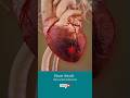 What Happens During A Heart Attack 3D Medical Animation Shorts HeartAttack Heart Health