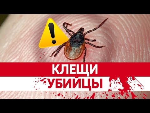 Суставы плечо хруст Симптомы воспаления суставов колена