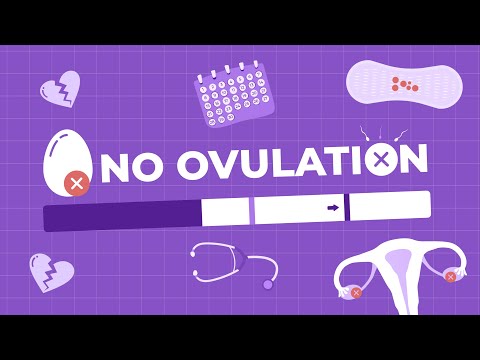 Ovulation Problems: Understanding Anovulation