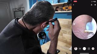LMECHN Ear Wax Removal, Earwax Remover 1920P Otoscope, Built-in WiFi, IP67 Waterproof and 8 Ear Tips