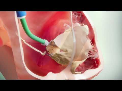 Medical Animation