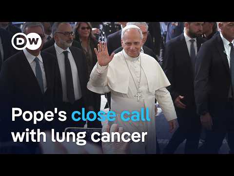 What we know about Pope Leo's cancer diagnosis after part of lung removed | DW News