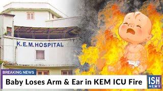Baby Loses Arm & Ear in KEM ICU Fire