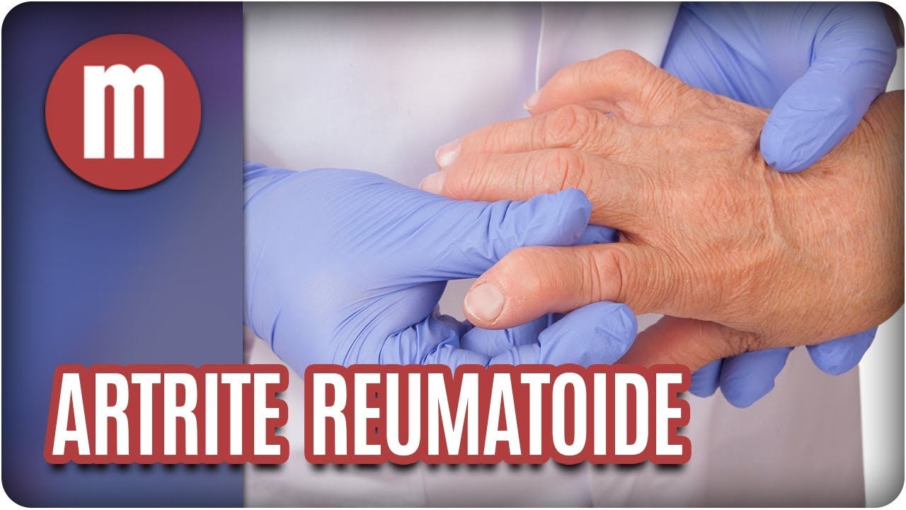 Saúde: artrite reumatoide - Mulheres (14/08/17)