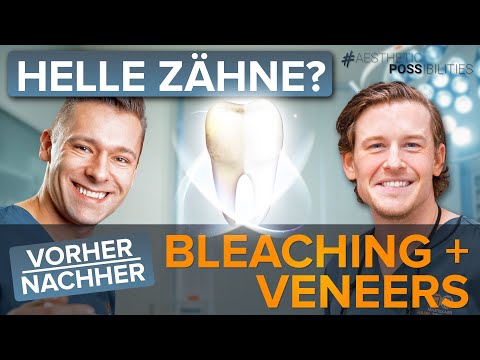 Combining bleaching and veneers for brighter teeth - Here's how it works ✅