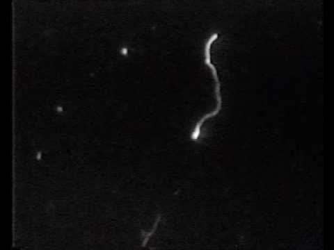 Dr Bozsik - Dark Field Microscopy DualDur (microscopie pe camp intunecat) - Borrelia Burgdorferi