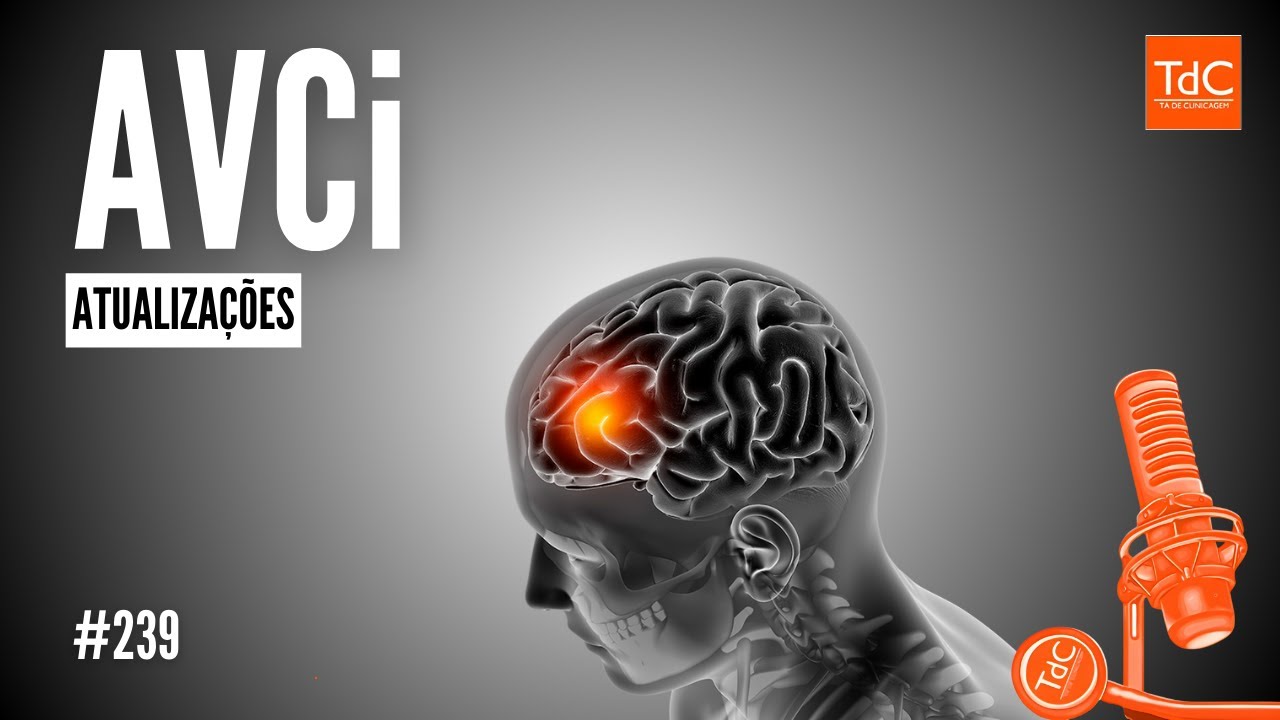 Episódio 239: AVC isquêmico [Atualizações]