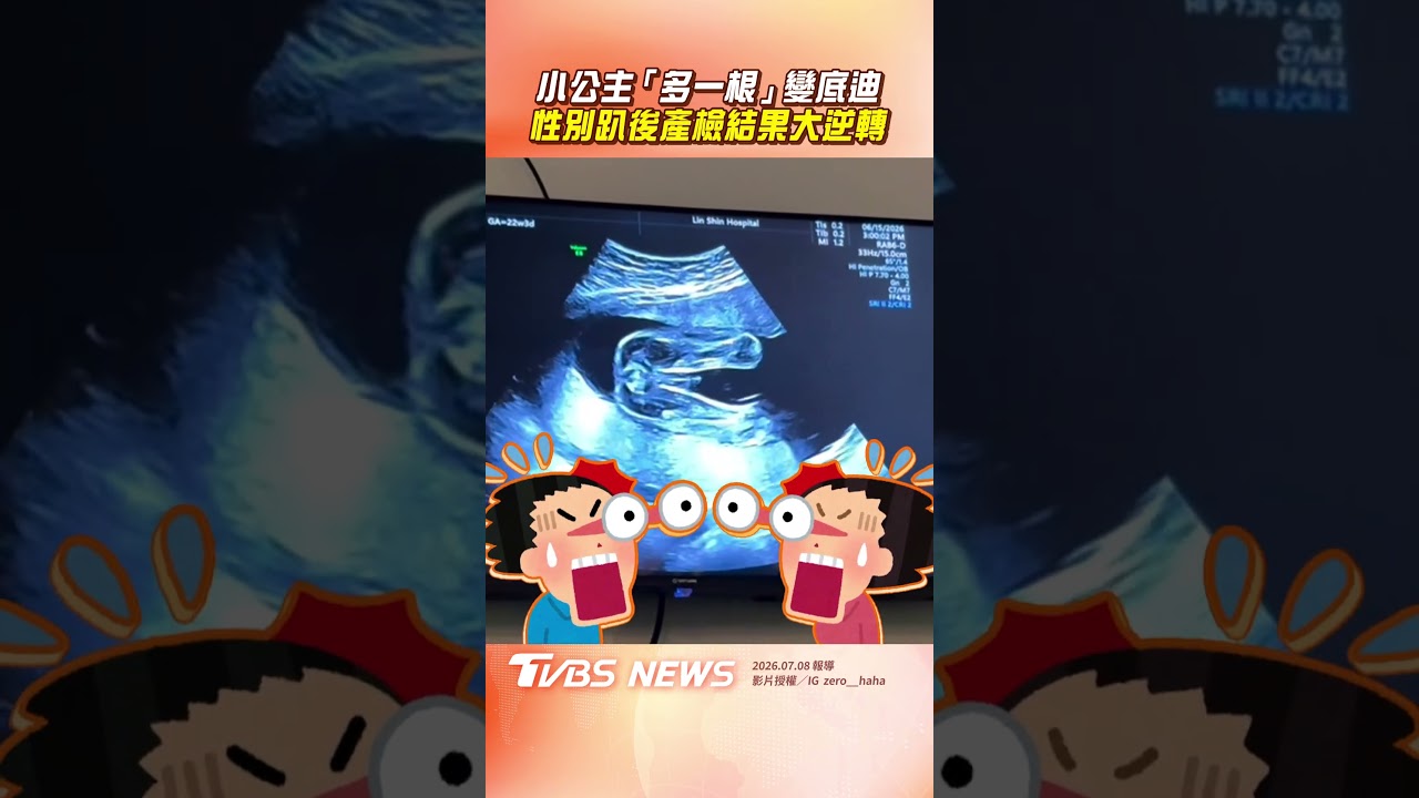影音/小公主照超音波「多一根」 性別趴後產檢大逆轉爸媽傻眼