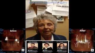 Dental Implants by Top Dentist in San Francisco, CA - Center for Implant Dentistry