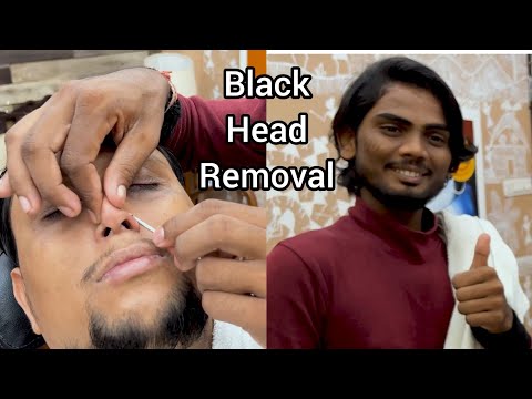 Black Head Removal and Face Massage by Michael Barber |Asmr Massage