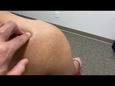 Palpation of the Shoulder Region