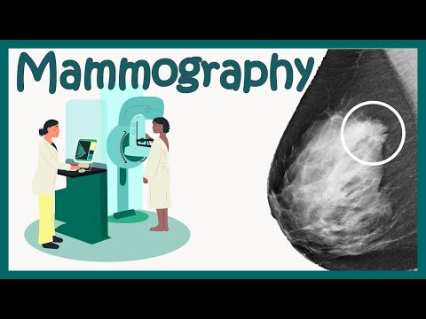 Mammography Test | Mammogram for breast cancer - What to expect | How to identify breast cancer