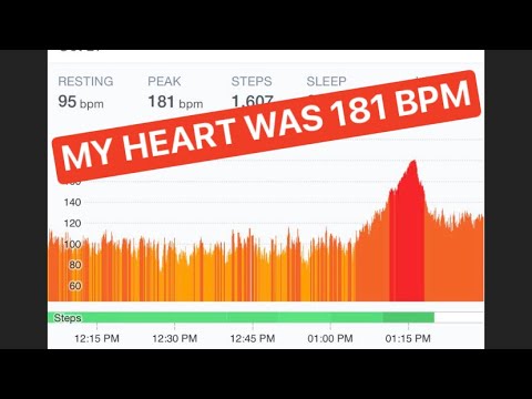 My Heart Was 181 BPM Dysautonomia Re-Testing
