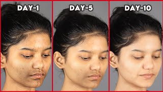 Get EVEN TONED Glowing Skin Naturally | Remove PIGMENTATION & DARK PATCHES Around Mouth Permanently