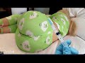 Scared Girl Crying During IM Injection At Home Safe Intramuscular Injection Step By Step