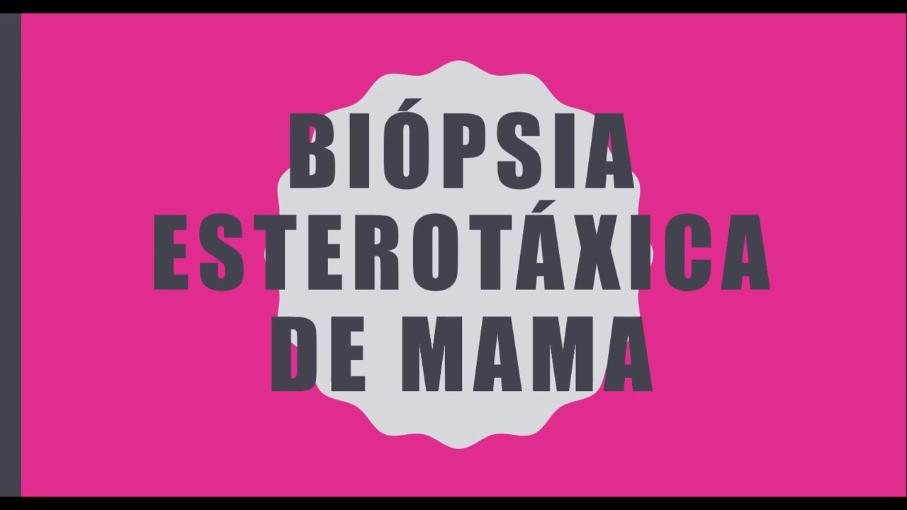 Mamografia parte 2 - Biópsia Estereotáxica de Mama