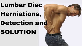 How to fix a herniated disc in the lumbar spine