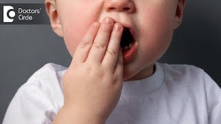 Do children need filling of milk tooth? - Dr. Maneesh Chandra Sharma
