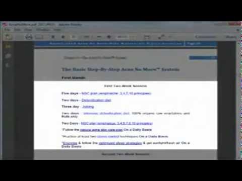 不再有粉刺(Acne No More Review -  Scam or Legit?)