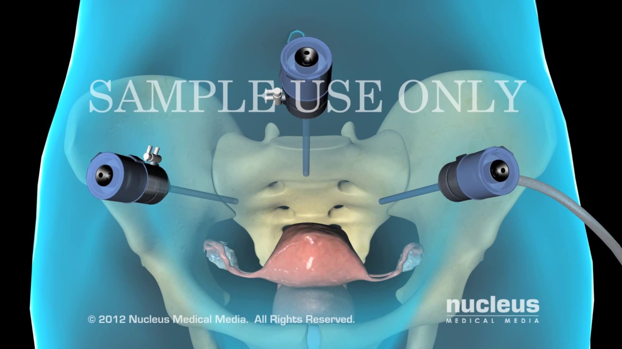 Griselda Reyes Torres-112