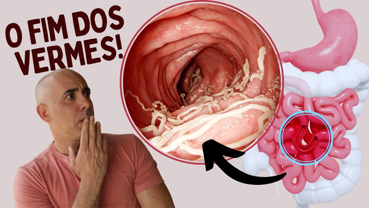 OS MELHORES REMÉDIOS NATURAIS CONTRA VERMES! | DR DAYAN SIEBRA #verme #vermes #verminose