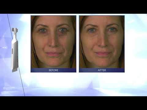 Magic Serum, jongere huid met dit anti-rimpel gezichtsserum