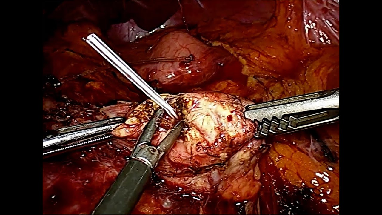 Michał Pędziwiatr-9