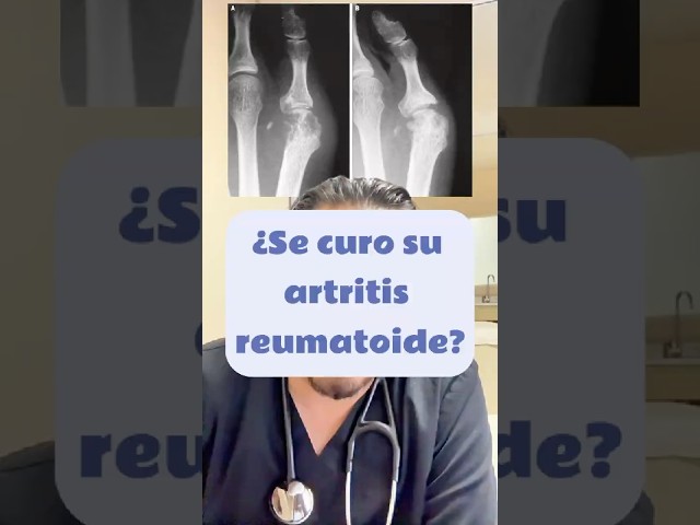 Vídeo relacionado con Guía de sanación con DMSO: Consejos de tratamiento natural para el dolor, la artritis, la inflamación y las enfermedades crónicas con dimetilsulfóxido