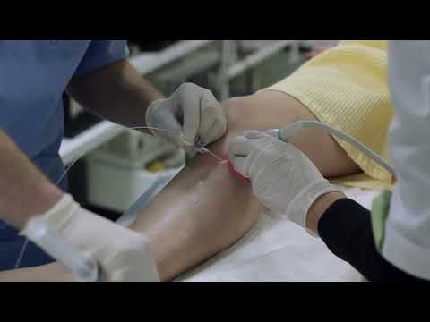Vene varicoase și artroză articulară, Ce sa tratam genunchiul varicos