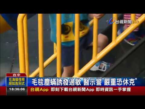 好癢!毛毯沒洗直接蓋 4歲童急性蕁麻疹