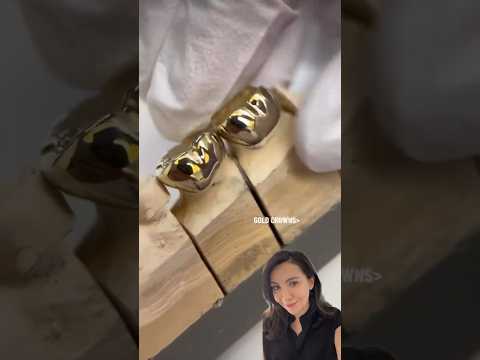 Differences between Gold dental crown & tooth color one!