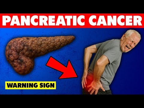 10 Symptoms of PANCREATIC CANCER To Watch Out For
