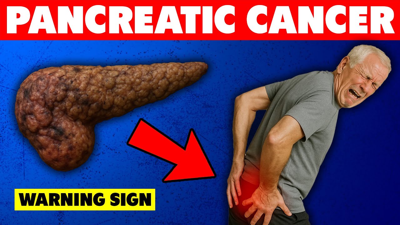 10 Symptoms of PANCREATIC CANCER To Watch Out For