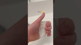 Hand rip😁
