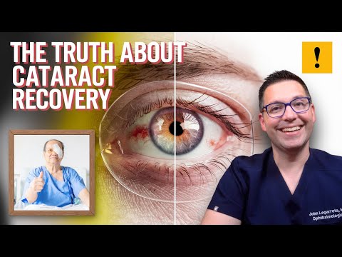 Cataract Surgery Recovery: 5 Surprises You Need To Know!