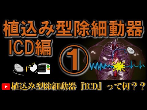 植込み型自動除細動器の定義