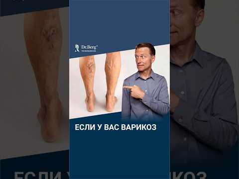 НИКОГДА не делайте это, если у вас варикоз. НИКОГДА не делайте это, если у вас варикоз.